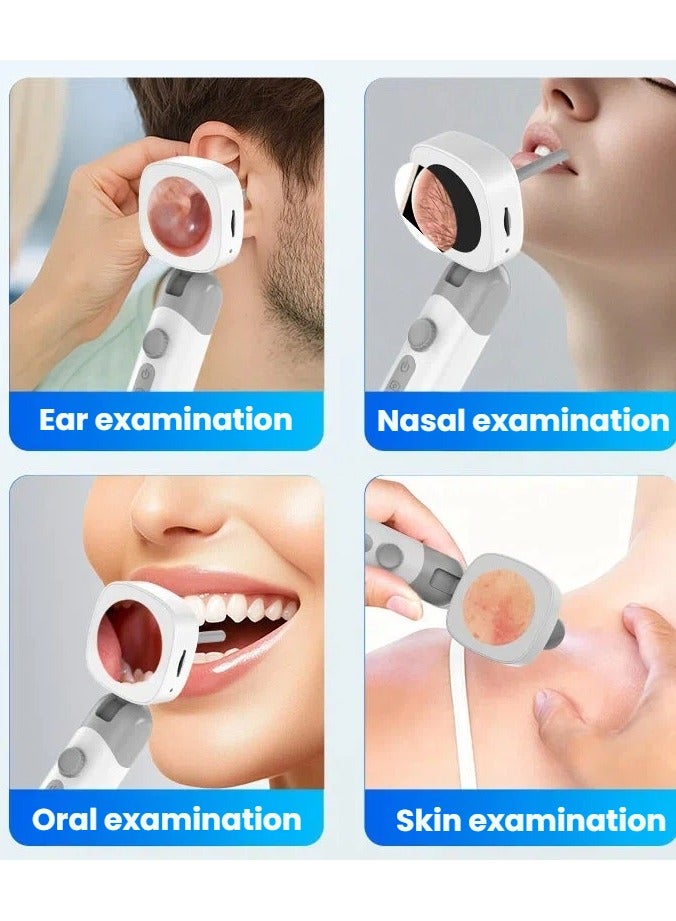 general Portable Digital Otoscope Handheld with Screen Photo Video Recording Ear Endoscope Type-C Rechargeable - Image 2